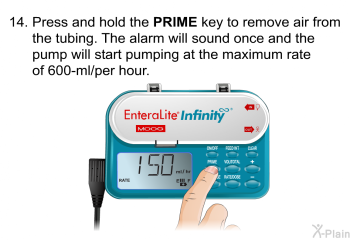<OL START=14> Press and hold the <B>PRIME</B> key to remove air from the tubing. The alarm will sound once and the pump will start pumping at the maximum rate of 600-ml/per hour.