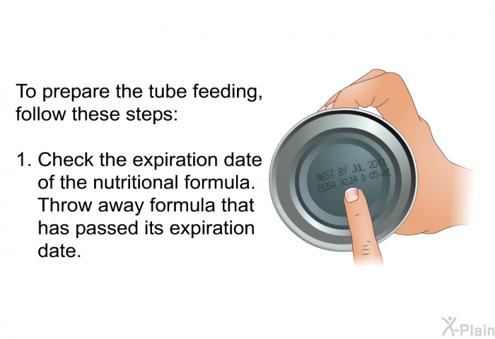 To prepare the tube feeding, follow these steps:  Check the expiration date of the nutritional formula. Throw away formula that has passed its expiration date.