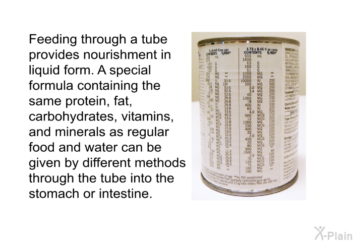 Feeding through a tube provides nourishment in liquid form. A special formula containing the same protein, fat, carbohydrates, vitamins, and minerals as regular food and water can be given by different methods through the tube into the stomach or intestine.