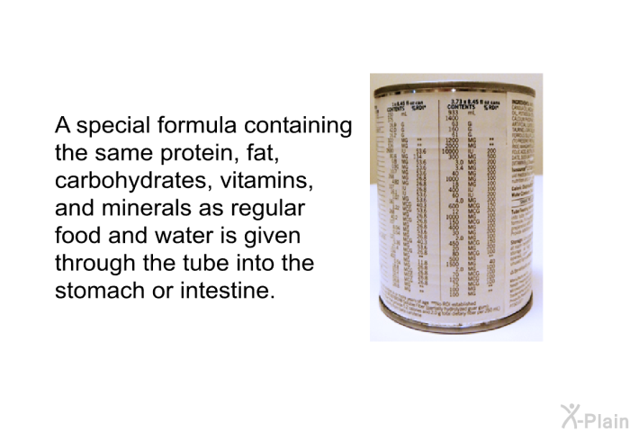 A special formula containing the same protein, fat, carbohydrates, vitamins, and minerals as regular food and water is given through the tube into the stomach or intestine.
