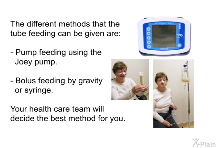 The different methods that the tube feeding can be given are:  Pump feeding using the Joey pump. Bolus feeding by gravity or syringe.  
 Your health care team will decide the best method for you.