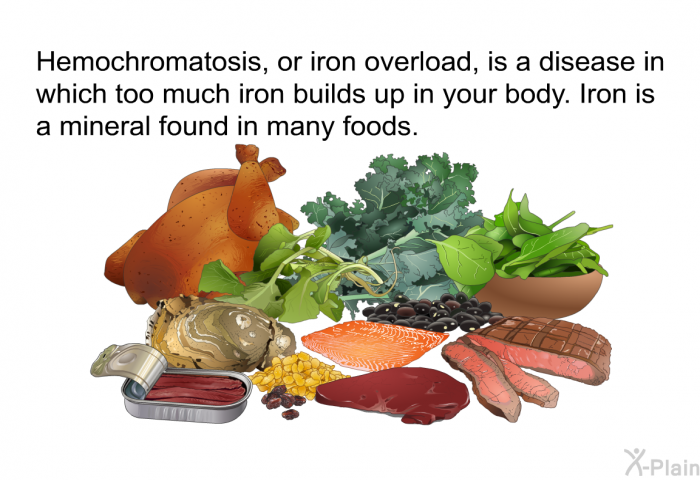 Hemochromatosis, or iron overload, is a disease in which too much iron builds up in your body. Iron is a mineral found in many foods.