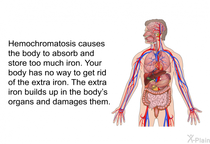 Hemochromatosis causes the body to absorb and store too much iron. Your body has no way to get rid of the extra iron. The extra iron builds up in the body's organs and damages them.