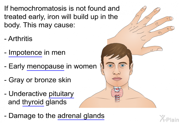 If hemochromatosis is not found and treated early, iron will build up in the body. This may cause:  Arthritis Impotence in men Early menopause in women Gray or bronze skin Underactive pituitary and thyroid glands Damage to the adrenal glands