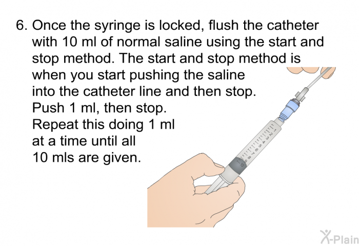 Once the syringe is locked, flush the catheter with 10 ml of normal saline using the start and stop method. The start and stop method is when you start pushing the saline into the catheter line and then stop. Push 1 ml, then stop. Repeat this doing 1 ml at a time until all 10 mls are given.