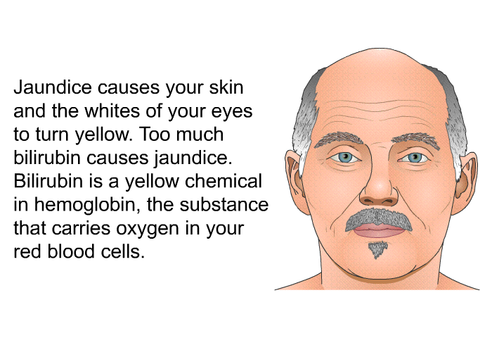 Jaundice causes your skin and the whites of your eyes to turn yellow. Too much bilirubin causes jaundice. Bilirubin is a yellow chemical in hemoglobin, the substance that carries oxygen in your red blood cells.