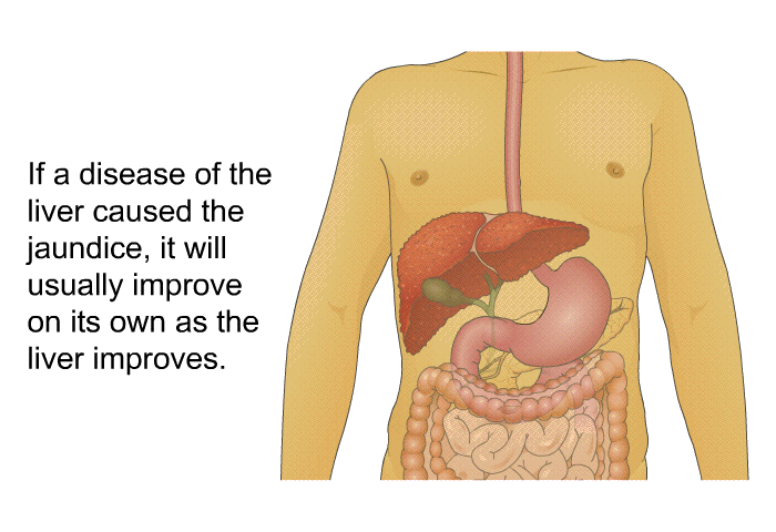 If a disease of the liver caused the jaundice, it will usually improve on its own as the liver improves.