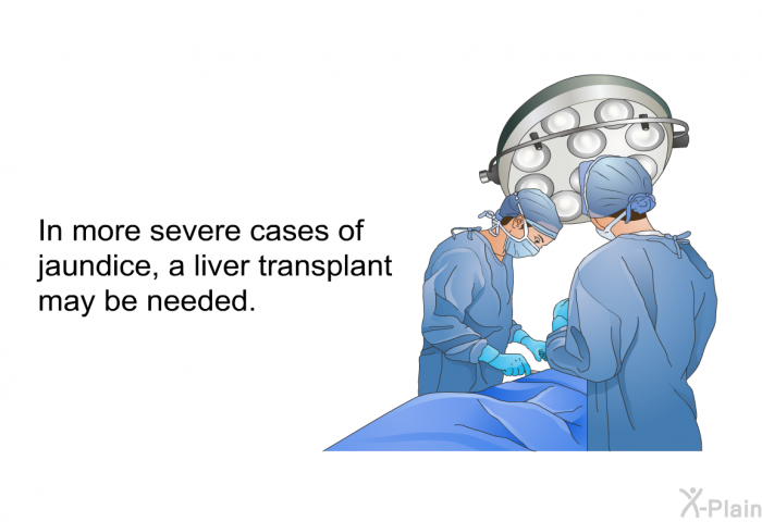 In more severe cases of jaundice, a liver transplant may be needed.
