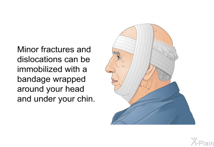Minor fractures and dislocations can be immobilized with a bandage wrapped around your head and under your chin.