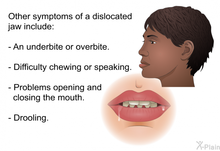 Other symptoms of a dislocated jaw include:  An underbite or overbite. Difficulty chewing or speaking. Problems opening and closing the mouth. Drooling.