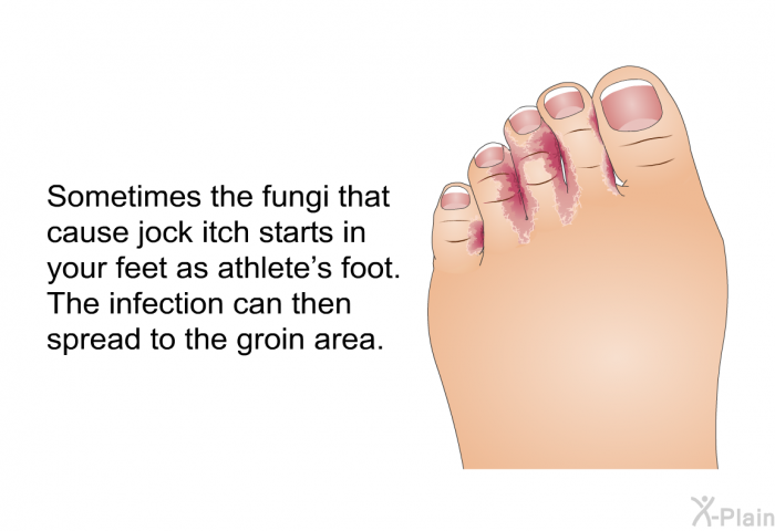 Sometimes the fungi that cause jock itch starts in your feet as athlete's foot. The infection can then spread to the groin area.