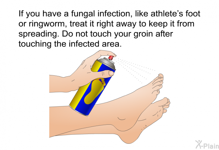 If you have a fungal infection, like athlete's foot or ringworm, treat it right away to keep it from spreading. Do not touch your groin after touching the infected area.