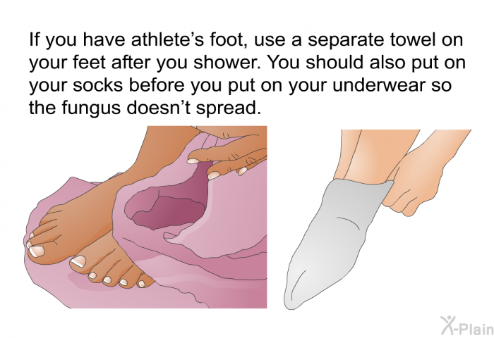 If you have athlete's foot, use a separate towel on your feet after you shower. You should also put on your socks before you put on your underwear so the fungus doesn't spread.