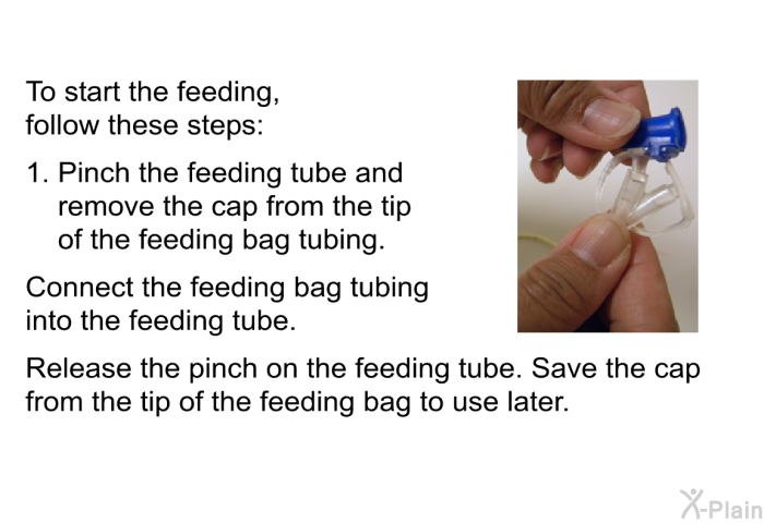 To start the feeding, follow these steps:  Pinch the feeding tube and remove the cap from the tip of the feeding bag tubing. Connect the feeding bag tubing into the feeding tube. Release the pinch on the feeding tube. Save the cap from the tip of the feeding bag to use later.