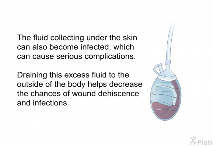 The fluid collecting under the skin can also become infected, which can cause serious complications. Draining this excess fluid to the outside of the body helps decrease the chances of wound dehiscence and infections