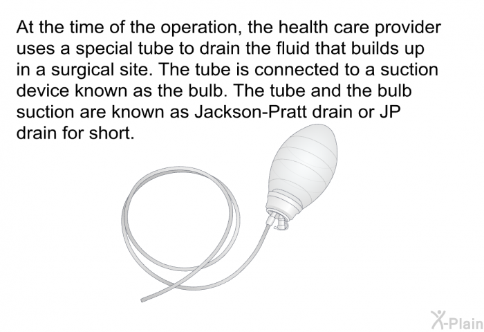 At the time of the operation, the health care provider uses a special tube to drain the fluid that builds up in a surgical site. The tube is connected to a suction device known as the bulb. The tube and the bulb suction are known as Jackson-Pratt drain or JP drain for short.