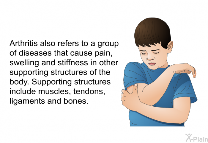 Arthritis also refers to a group of diseases that cause pain, swelling and stiffness in other supporting structures of the body. Supporting structures include muscles, tendons, ligaments and bones.