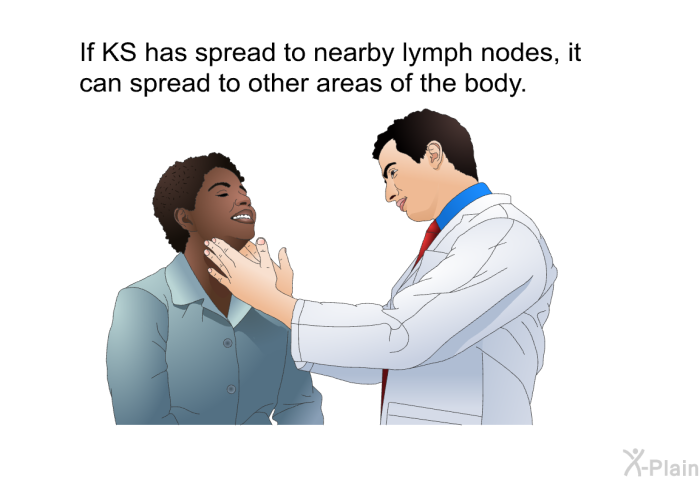 If KS has spread to nearby lymph nodes, it can spread to other areas of the body.