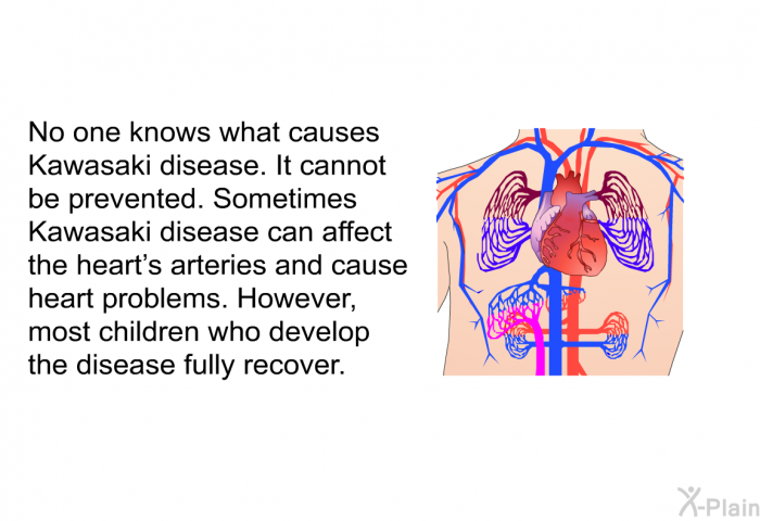 No one knows what causes Kawasaki disease. It cannot be prevented. Sometimes Kawasaki disease can affect the heart's arteries and cause heart problems. However, most children who develop the disease fully recover.