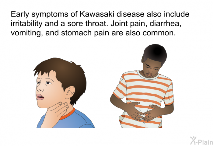 Early symptoms of Kawasaki disease also include irritability and a sore throat. Joint pain, diarrhea, vomiting, and stomach pain are also common.