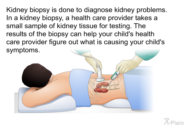 Kidney biopsy is done to diagnose kidney problems. In a kidney biopsy, a health care provider takes a small sample of kidney tissue for testing. The results of the biopsy can help your child's health care provider figure out what is causing your child's symptoms.