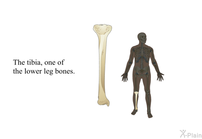 The tibia, one of the lower leg bones.
