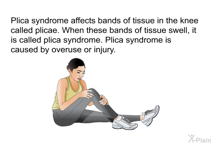 Plica syndrome affects bands of tissue in the knee called plicae. When these bands of tissue swell, it is called plica syndrome. Plica syndrome is caused by overuse or injury.
