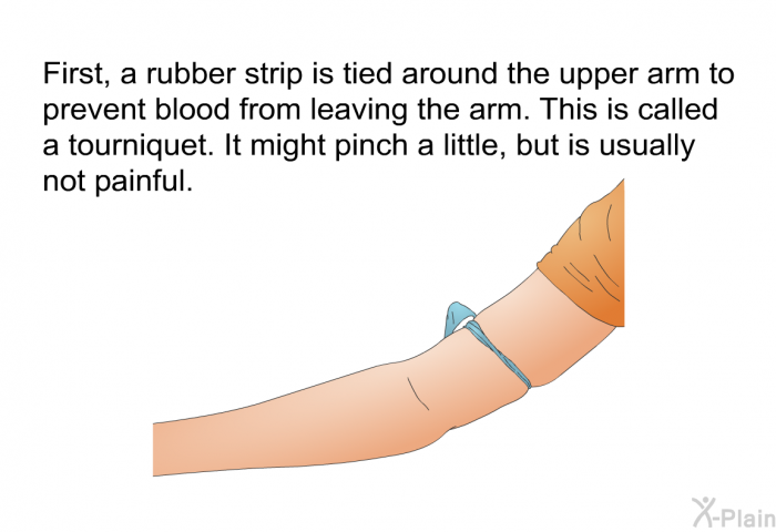 First, a rubber strip is tied around the upper arm to prevent blood from leaving the arm. This is called a tourniquet. It might pinch a little, but is usually not painful.