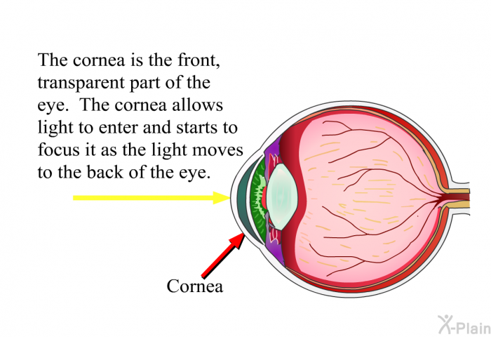 The cornea is the front, transparent part of the eye. The cornea allows light to enter and starts to focus it as the light moves to the back of the eye.