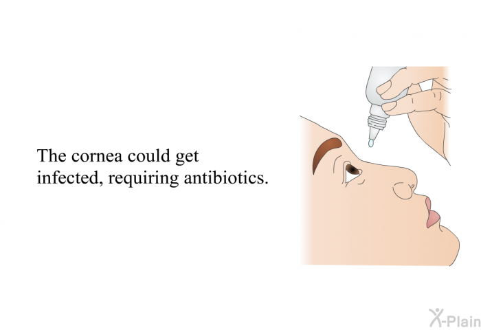 The cornea could get infected, requiring antibiotics.