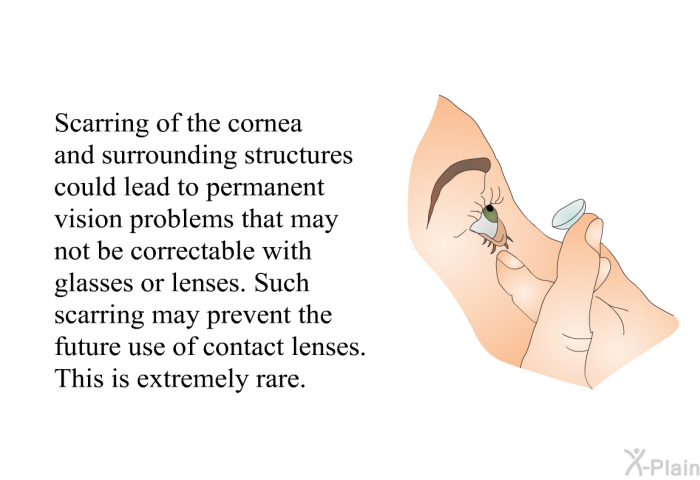 Scarring of the cornea and surrounding structures could lead to permanent vision problems that may not be correctable with glasses or lenses. Such scarring may prevent the future use of contact lenses. This is extremely rare.
