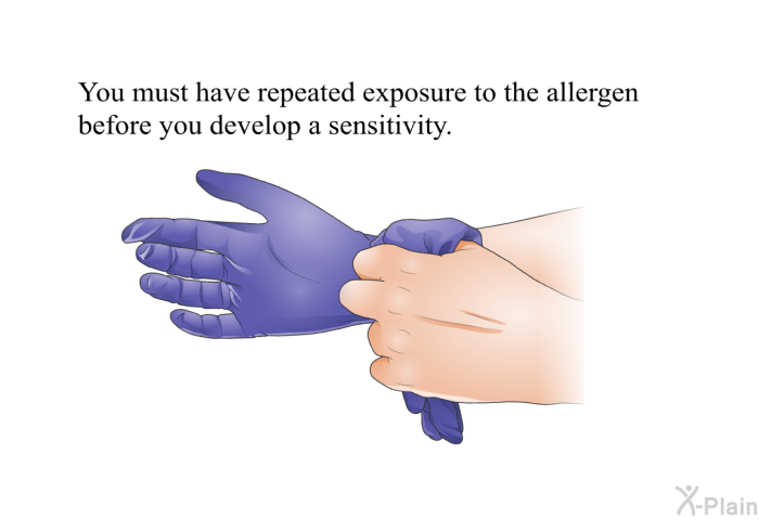 You must have repeated exposure to the allergen before you develop a sensitivity.