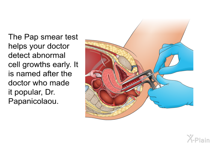 The Pap smear test helps your doctor detect abnormal cell growths early. It is named after the doctor who made it popular, Dr. Papanicolaou.