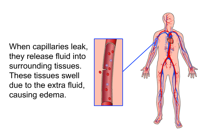 When capillaries leak, they release fluid into surrounding tissues. These tissues swell due to the extra fluid, causing edema.