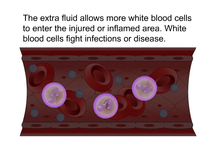 The extra fluid allows more white blood cells to enter the injured or inflamed area. White blood cells fight infections or disease.