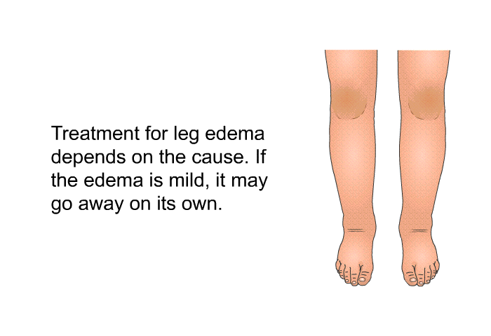 Treatment for leg edema depends on the cause. If the edema is mild, it may go away on its own.