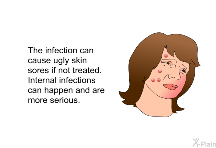 The infection can cause ugly skin sores if not treated. Internal infections can happen and are more serious.