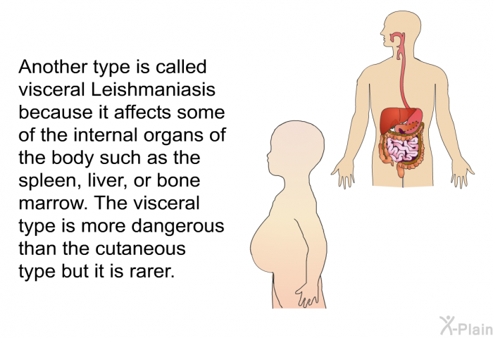 Another type is called visceral Leishmaniasis because it affects some of the internal organs of the body such as the spleen, liver, or bone marrow. The visceral type is more dangerous than the cutaneous type but it is rarer.