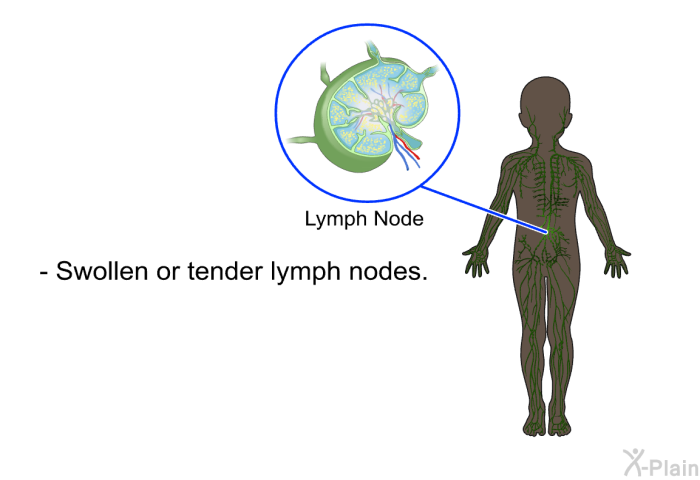 Swollen or tender lymph<I> </I>nodes.