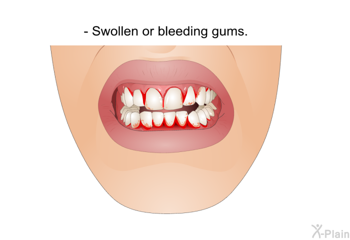 Swollen or bleeding gums.