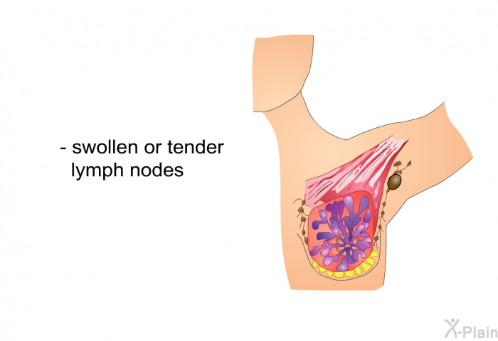 swollen or tender lymph<I> </I>nodes