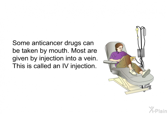 Some anticancer drugs can be taken by mouth. Most are given by injection into a vein. This is called an <I>IV injection</I>.