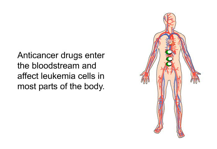 Anticancer drugs enter the bloodstream and affect leukemia cells in most parts of the body.