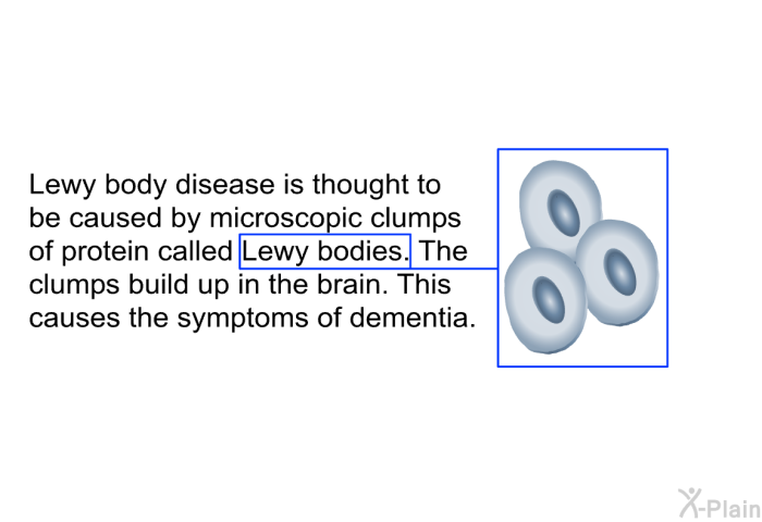 Lewy body disease is thought to be caused by microscopic clumps of protein called Lewy bodies. The clumps build up in the brain. This causes the symptoms of dementia.