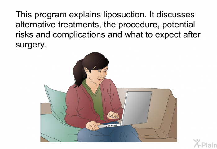 This health information explains liposuction. It discusses alternative treatments, the procedure, potential risks and complications and what to expect after surgery.
