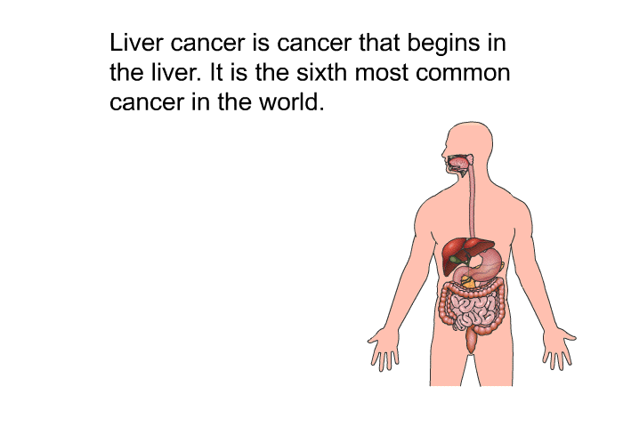 Liver cancer is cancer that begins in the liver. It is the sixth most common cancer in the world.