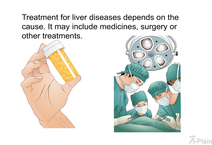 Treatment for liver diseases depends on the cause. It may include medicines, surgery or other treatments.