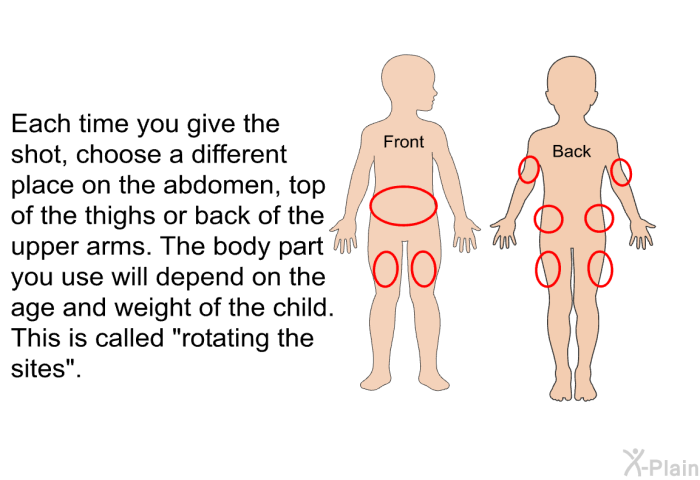 Each time you give the shot, choose a different place on the abdomen, top of the thighs or back of the upper arms. The body part you use will depend on the age and weight of the child. This is called “rotating the sites”.