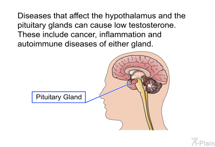 Diseases that affect the hypothalamus and the pituitary glands can cause low testosterone. These include cancer, inflammation and autoimmune diseases of either gland.