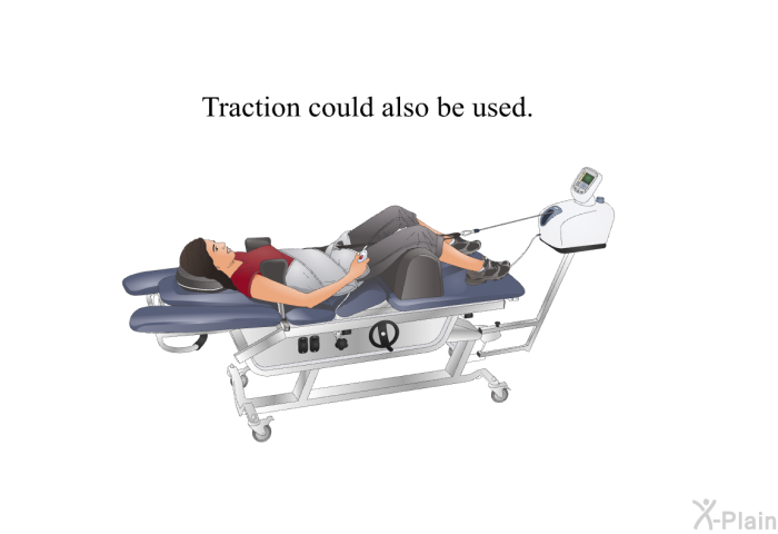 Traction could also be used.